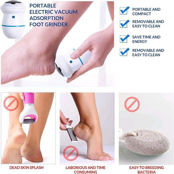 Electric Foot Callus Remover With Built-in Vacuum